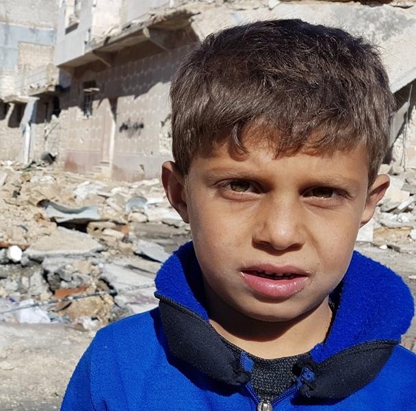 Aleppo: mending wounds of the little Syrians