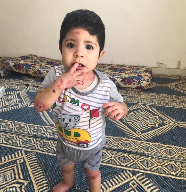 Like butterfly wings: interview with Dr. Banfi